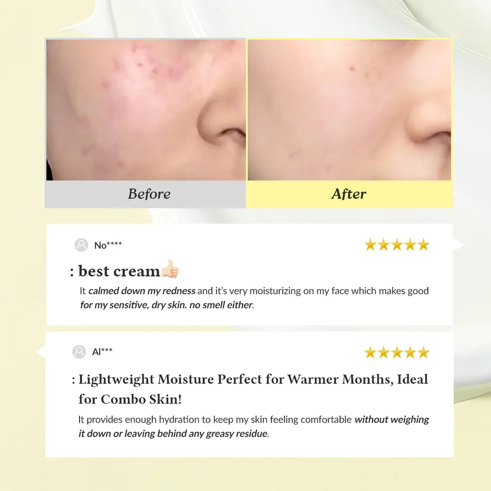 Dr. Althea Post Acne Care Set (Boosting) | 345 Relief Cream & Vitamin C Boosting Serum