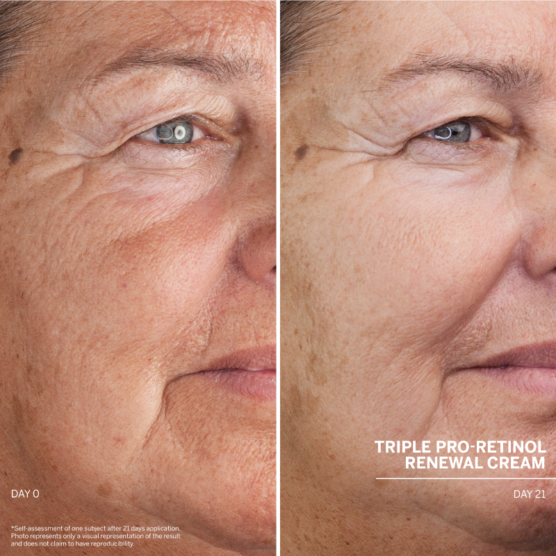 Dr. Babor Triple Pro-Retinol Renewal Cream
