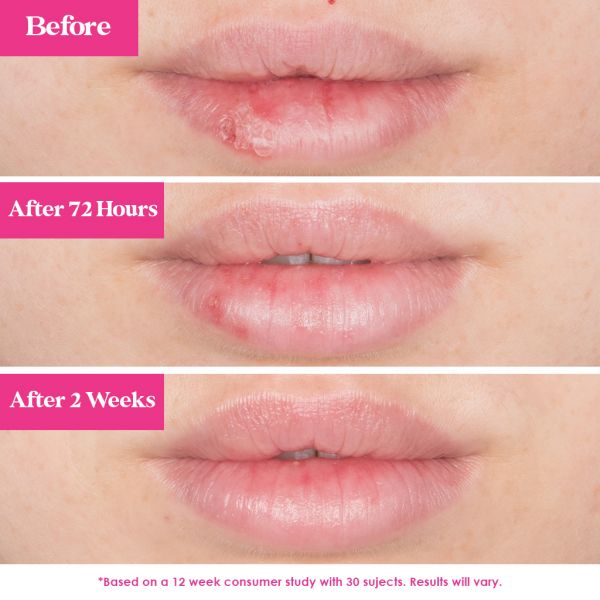 GrandePOUT Plumping Lip Mask Peach