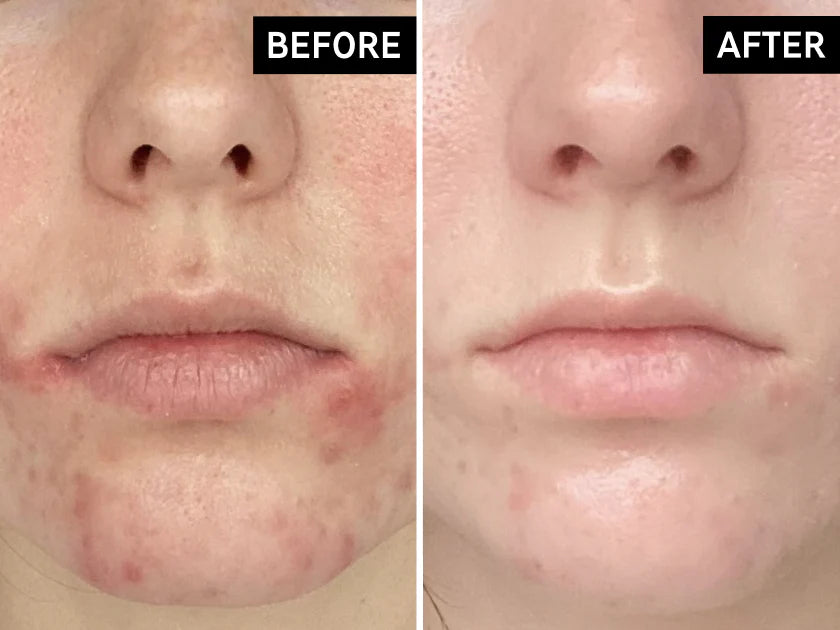 THE INKEY LIST C-50 SERUM