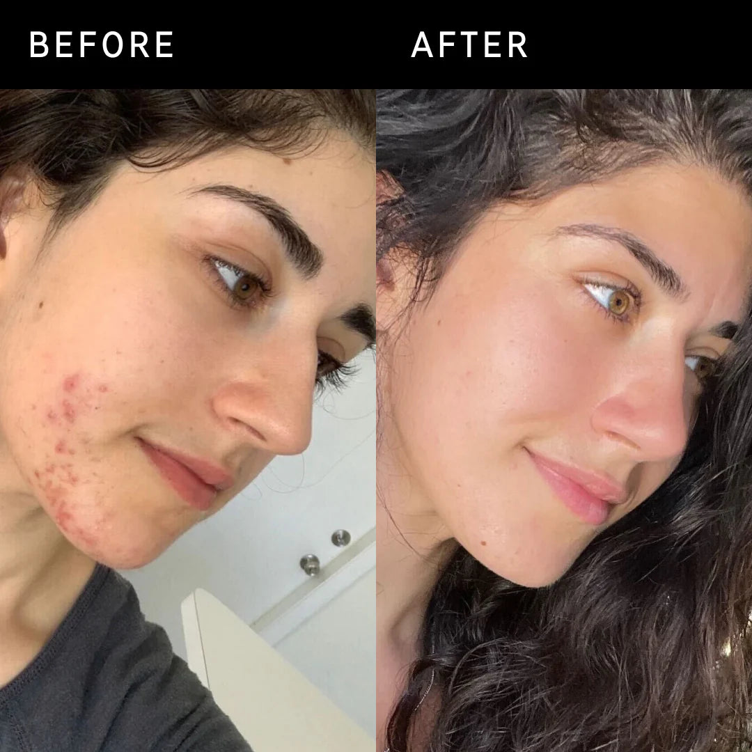 THE INKEY LIST SUCCINIC ACID TREATMENT