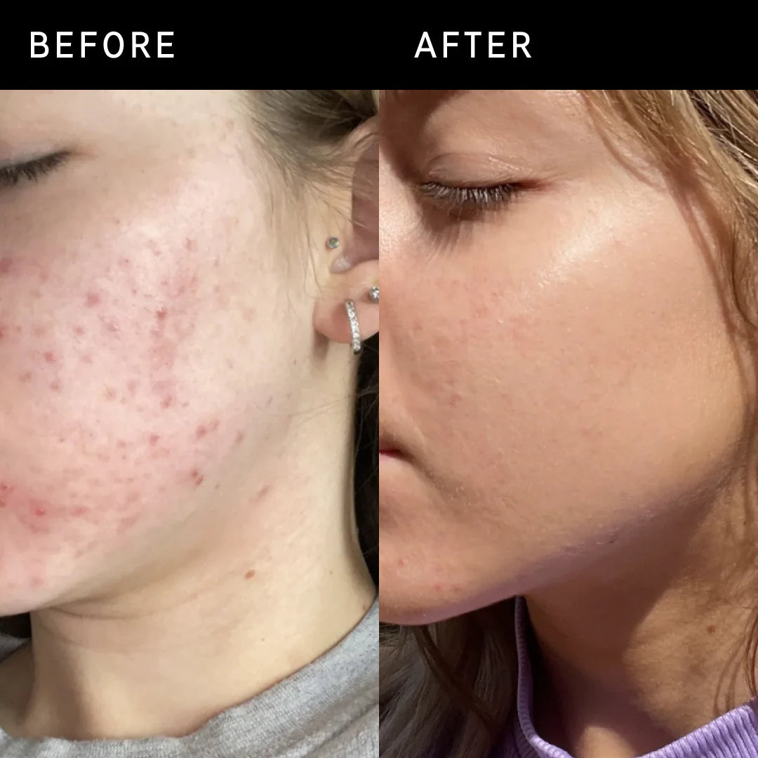THE INKEY LIST NIACINAMIDE SERUM (10%)