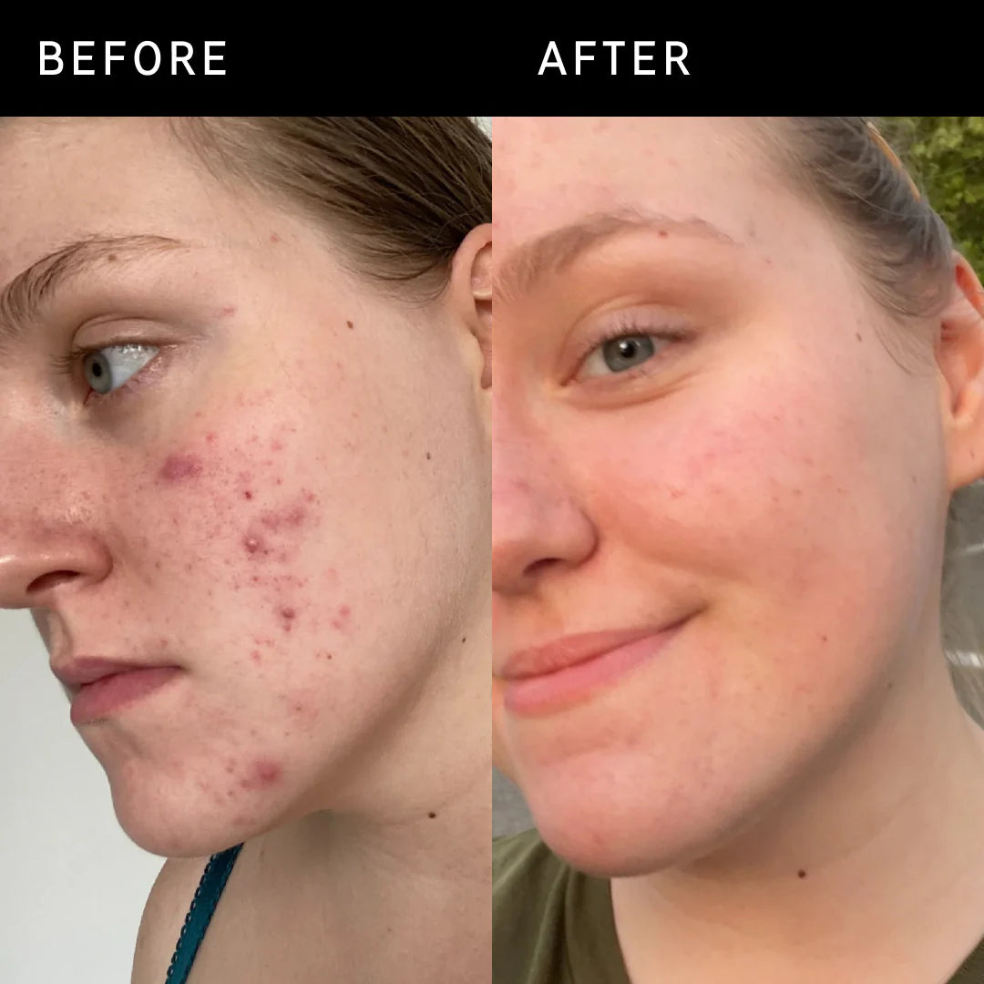 THE INKEY LIST 15% VITAMIN C AND EGF SERUM