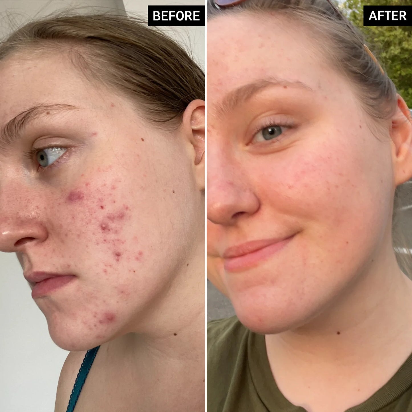 THE INKEY LIST GLYCOLIC ACID TONER