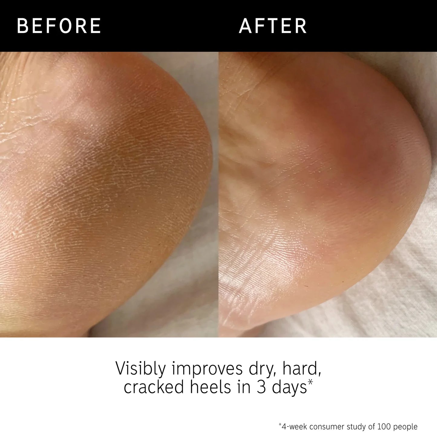 The Inkey List Glycolic Acid Exfoliating Body Stick