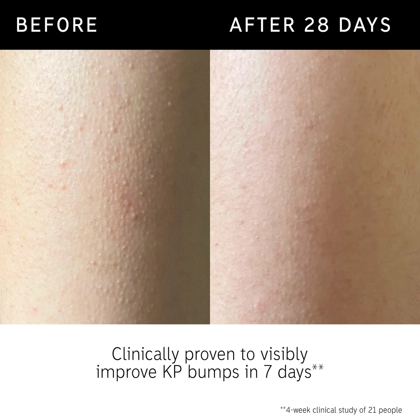 The Inkey List Glycolic Acid Exfoliating Body Stick