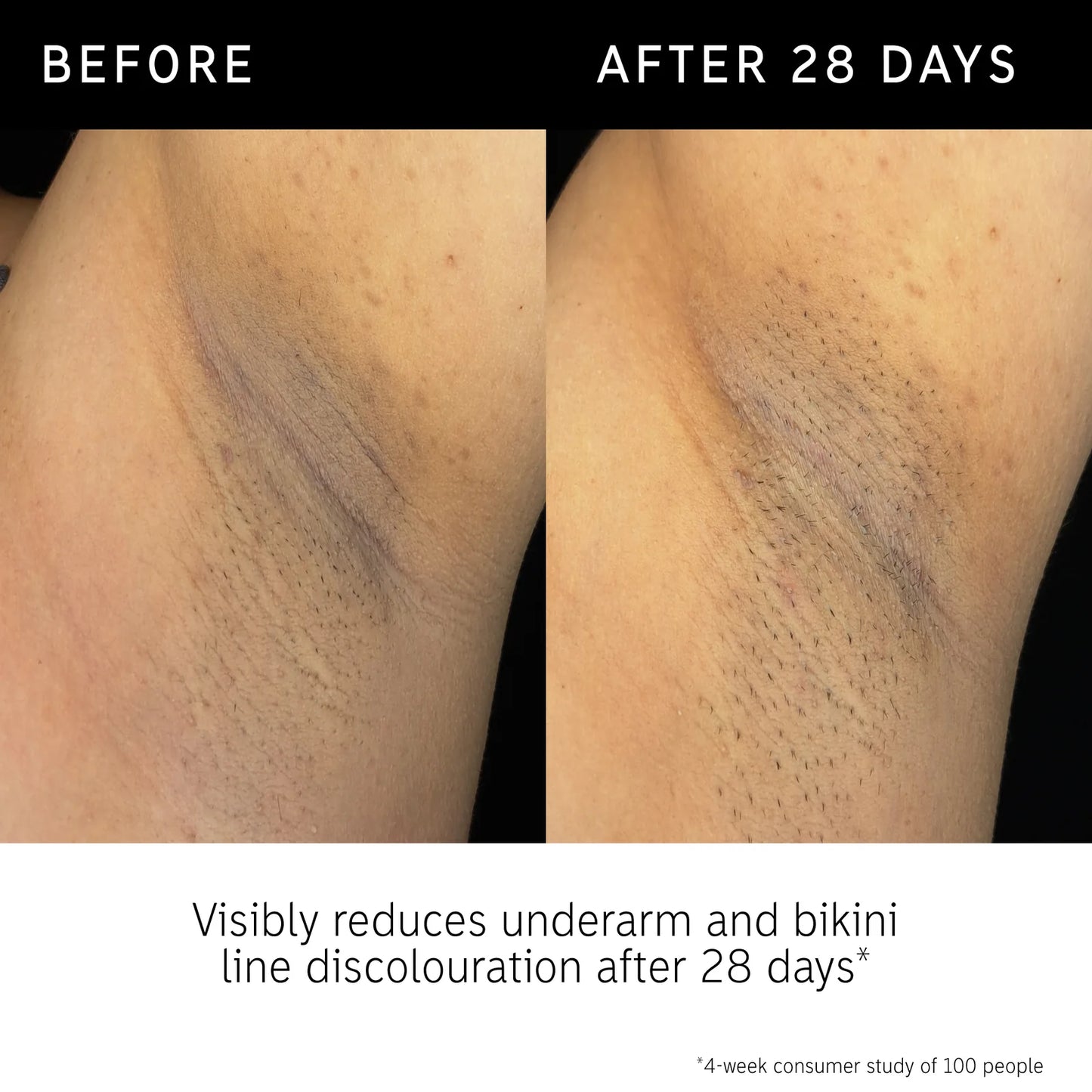 The Inkey List Glycolic Acid Exfoliating Body Stick
