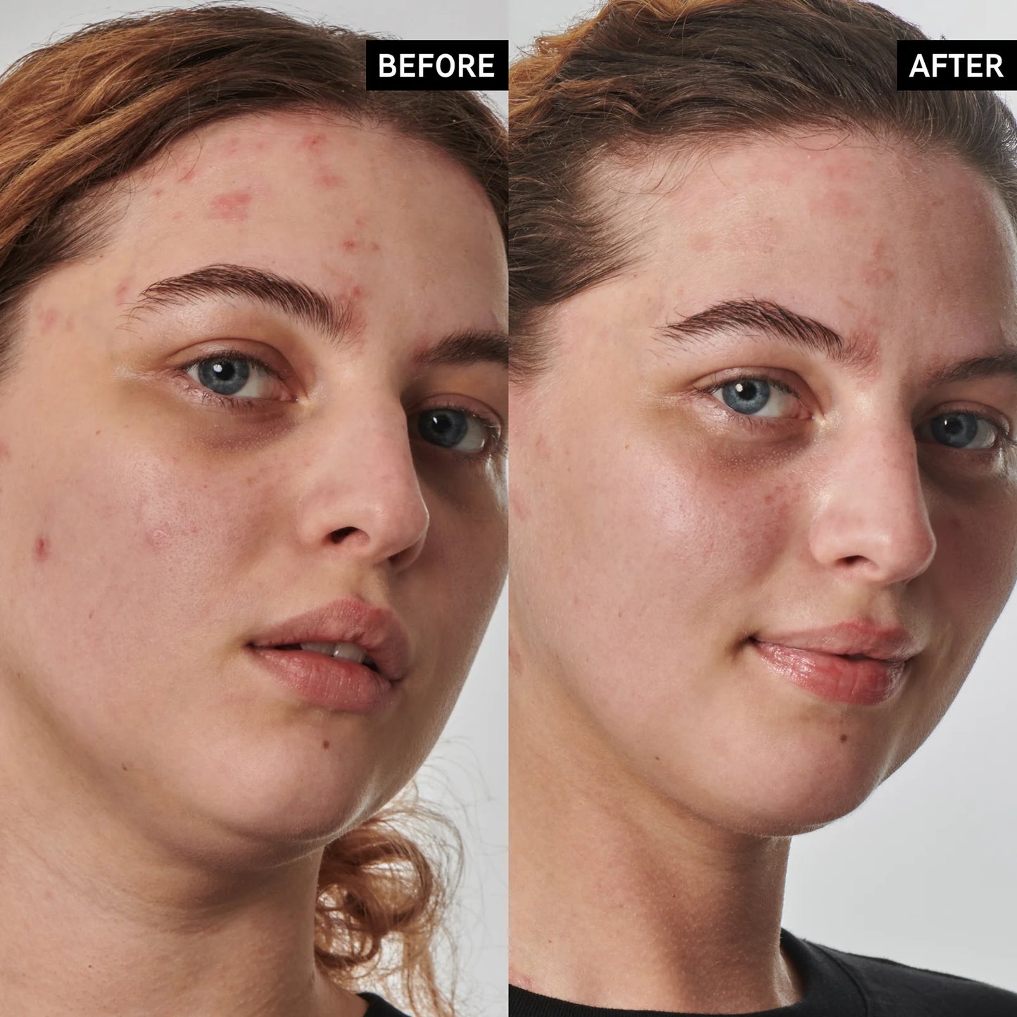 THE INKEY LIST SUPERSOLUTIONS 10% UREA MOISTURIZER