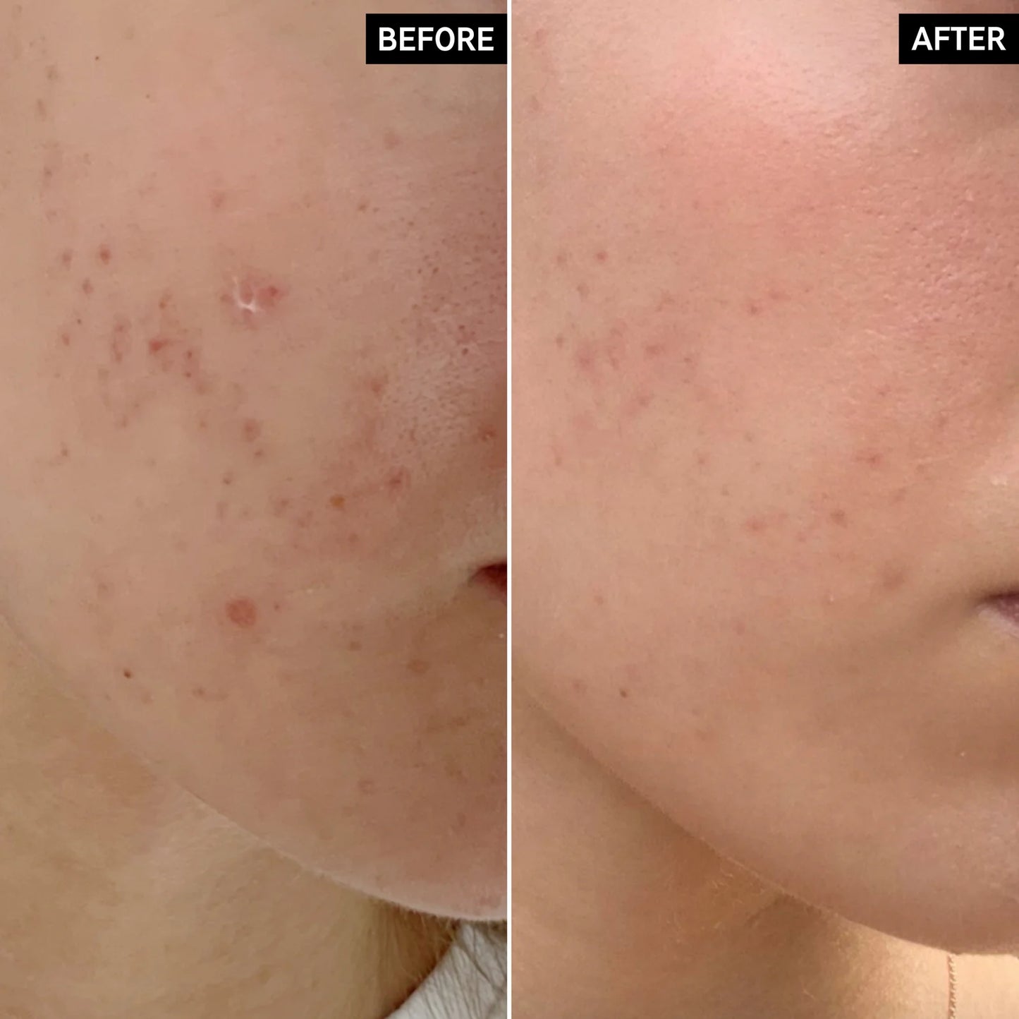 THE INKEY LIST MANDELIC ACID TREATMENT