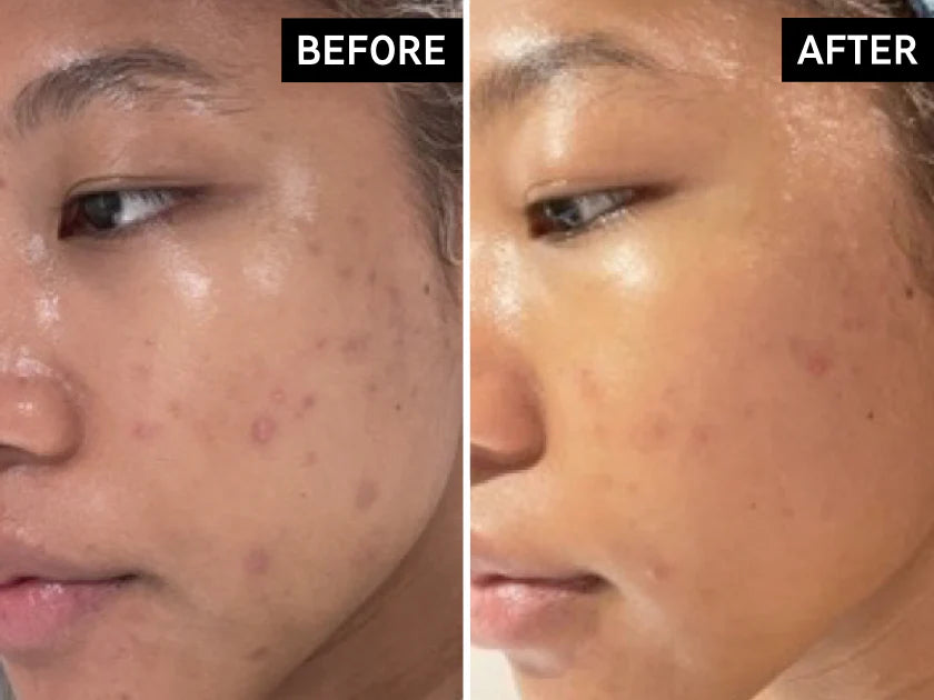 THE INKEY LIST C-50 SERUM
