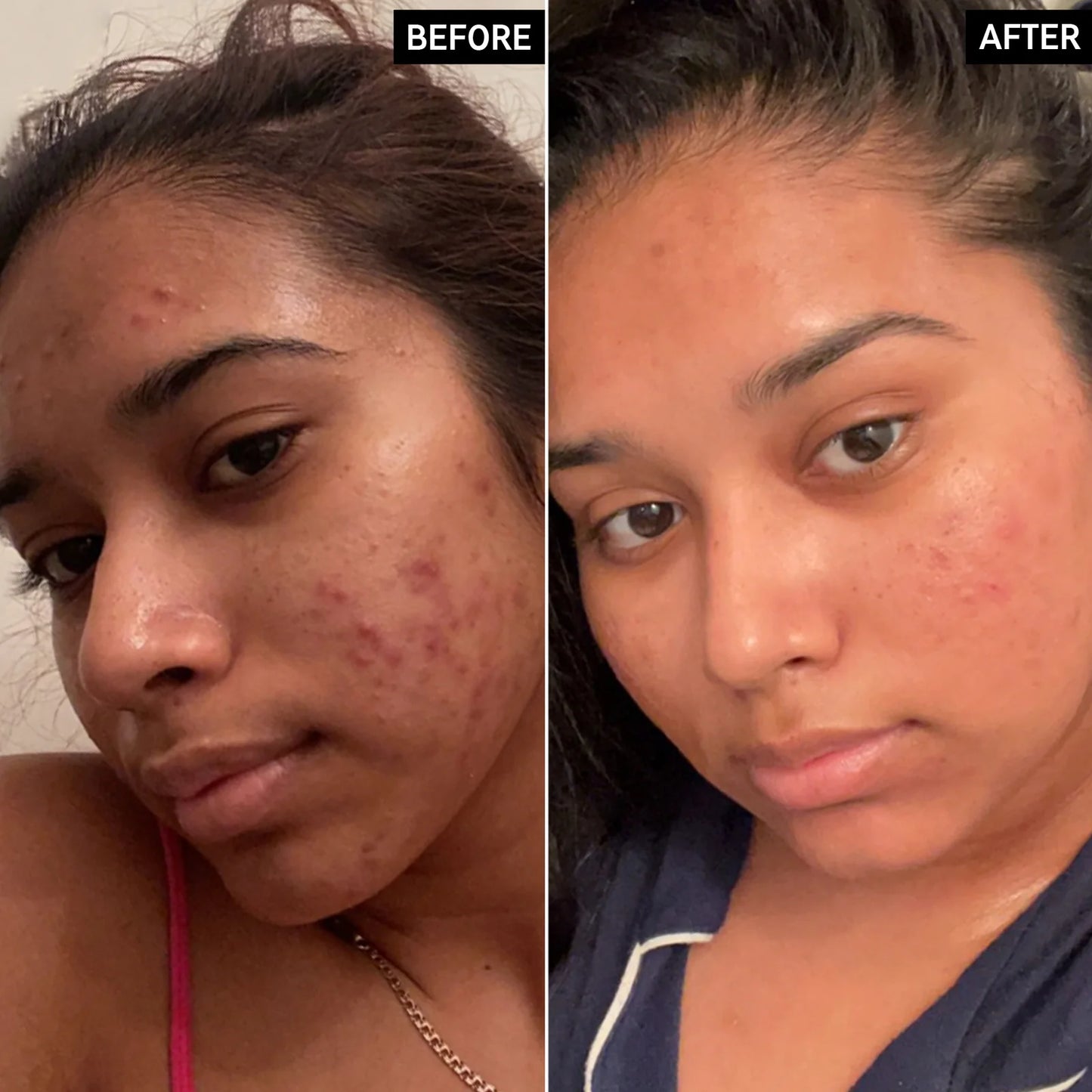 THE INKEY LIST 15% VITAMIN C AND EGF SERUM