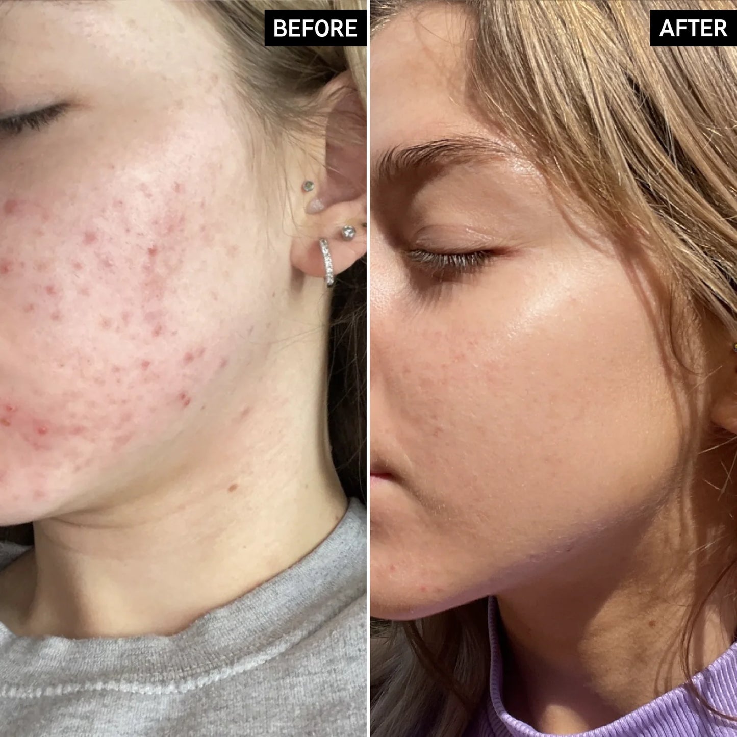 THE INKEY LIST BETA HYDROXY ACID SERUM (BHA)