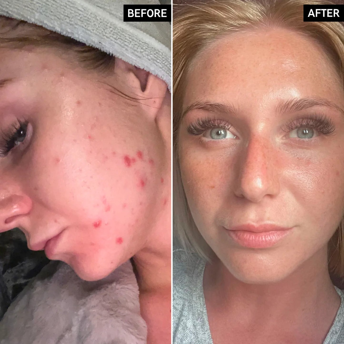 THE INKEY LIST BETA HYDROXY ACID SERUM (BHA)