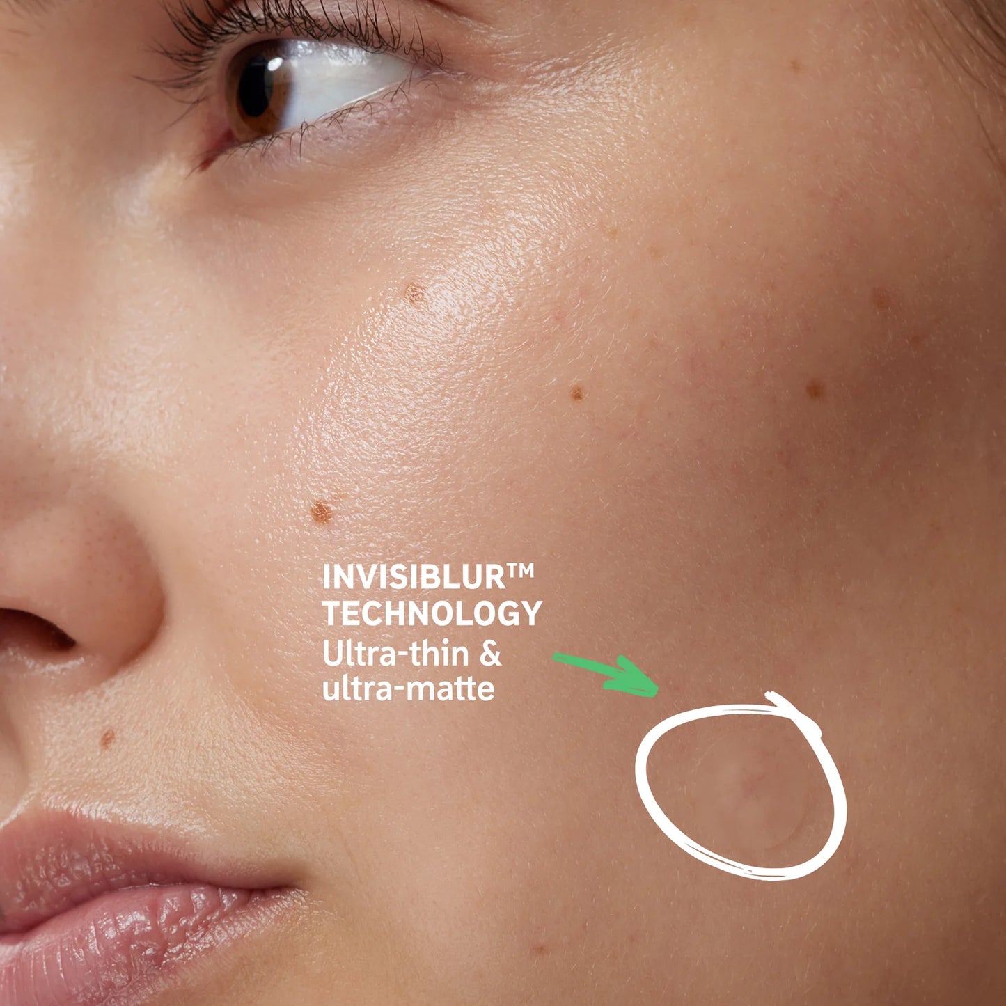 The Inkey List Hydrocolloid Invisible Pimple Patches