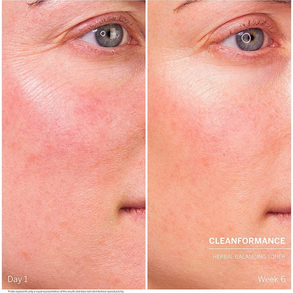 Dr. Babor Cleanformance Herbal Balancing Toner