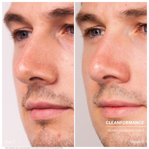 Dr. Babor Cleanformance Herbal Balancing Toner