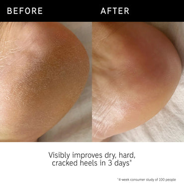 The Inkey List Glycolic Acid Exfoliating Body Stick